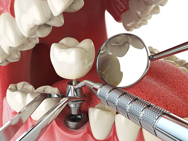 Best Weekend Emergency Dentist in Coronita, CA